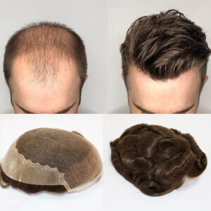 Brown Front with Skin in the Back Hair Replacement System postich
